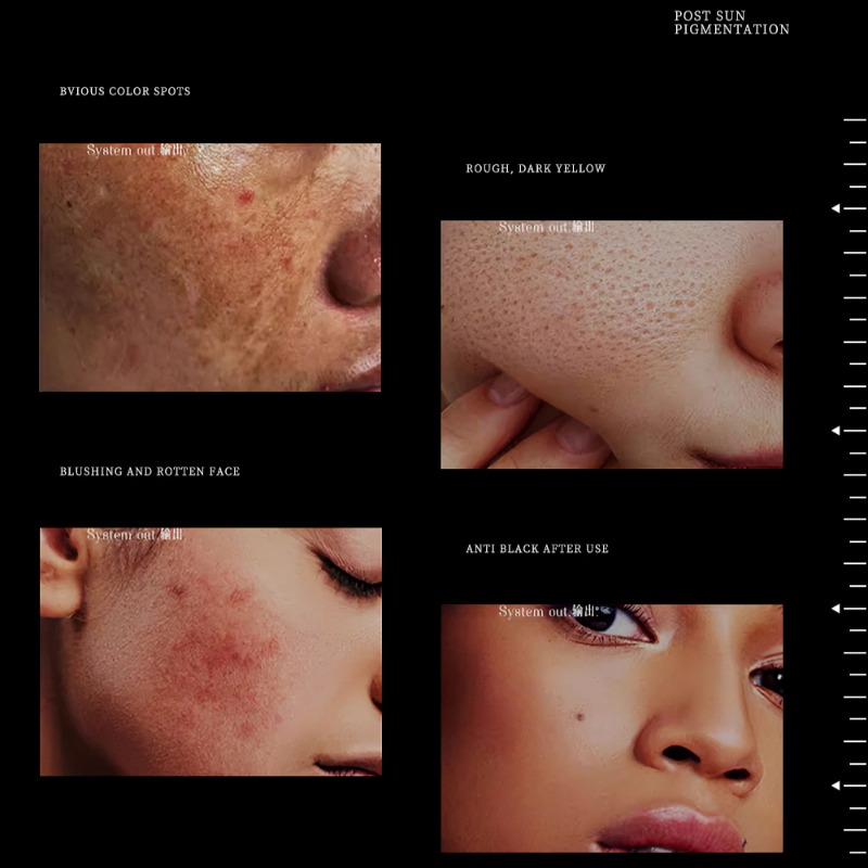 1.94온스 천연 럭셔리 나이아신아마이드 브라이트닝 페 - Skincare Luxury Whitening 리뷰 및 가격