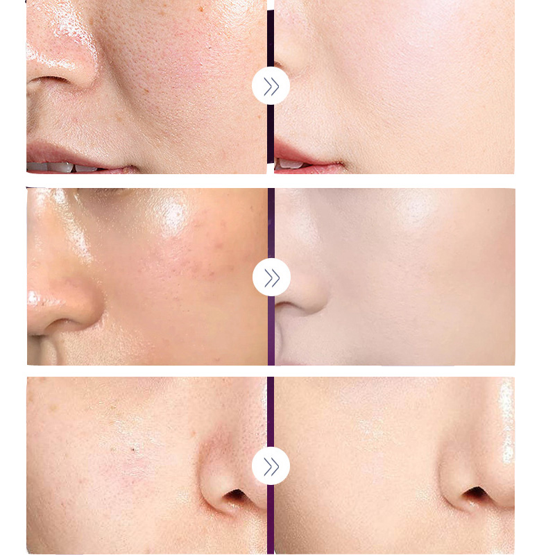럭셔리 노블 레이디 크림, 진주 미백 페이스 크림, 모 - Skincare Luxury Whitening 리뷰 및 가격