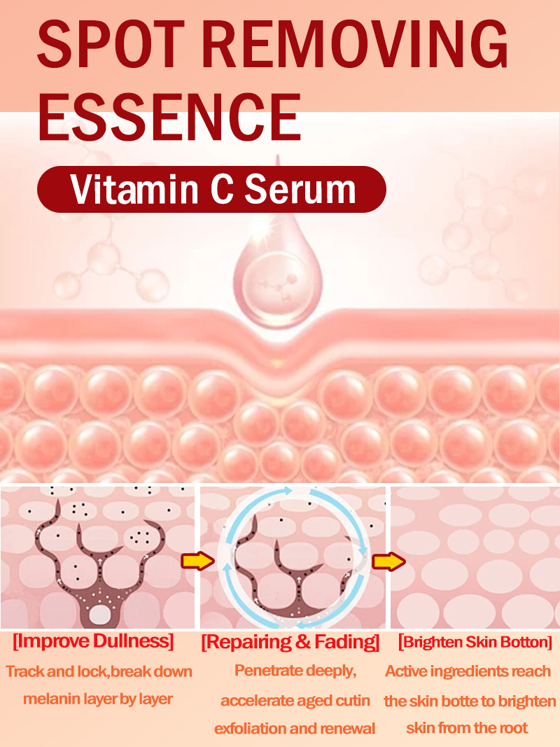 주근깨, 기미, 얼굴의 검은 반점 완화 - Skincare Luxury Whitening 리뷰 및 가격